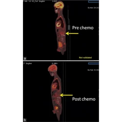 Article figure