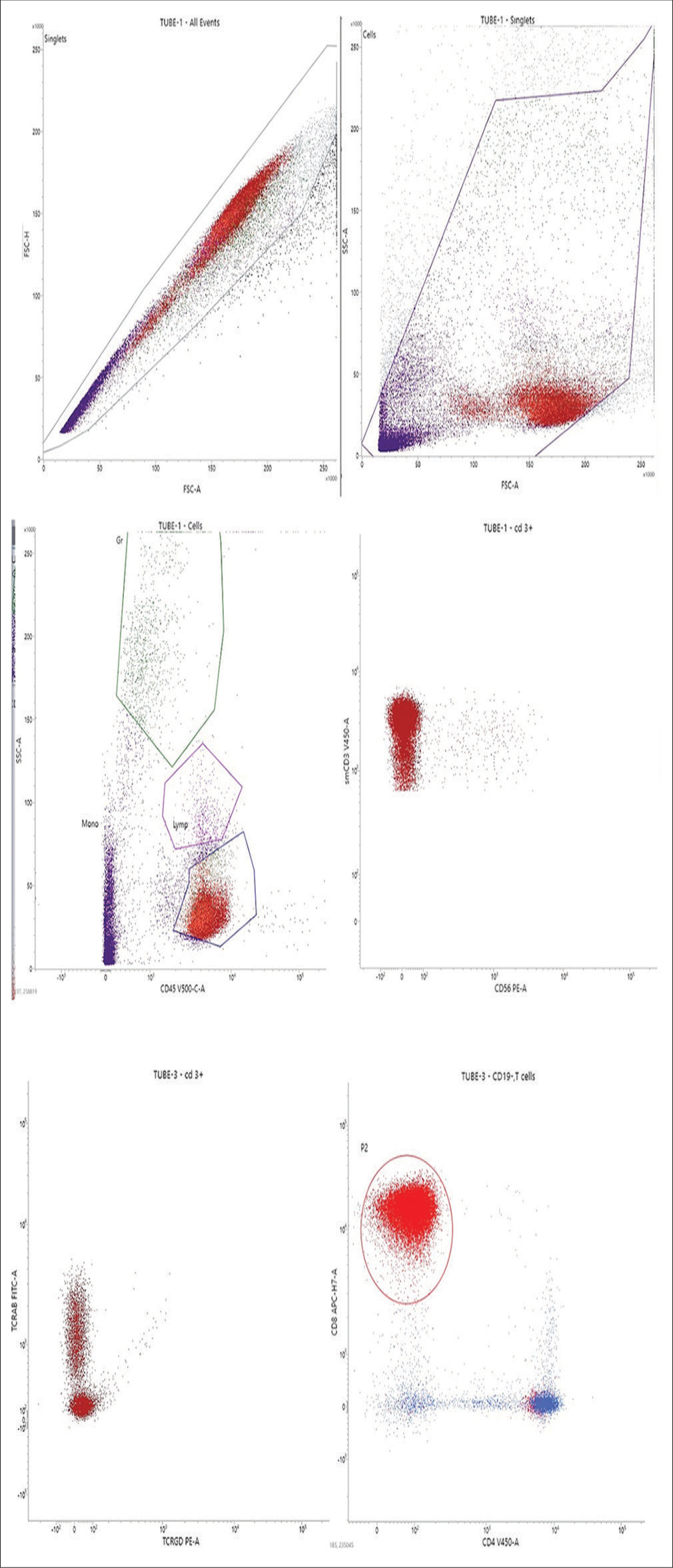 Flow cytometry plots from the Peripheral blood with various cluster differentiation (CD) markers and TCell receptor alphabeta (TCRAB) TCell receptor gamma delta (TCRGD). The mature T cells showed uniform positivity for surface CD3 and CD8. The various flourochromes used for tagging are FITC: Flouroscine iso thiocyanate, PE: Phyco erythrine, APC: Allophycocyanine.