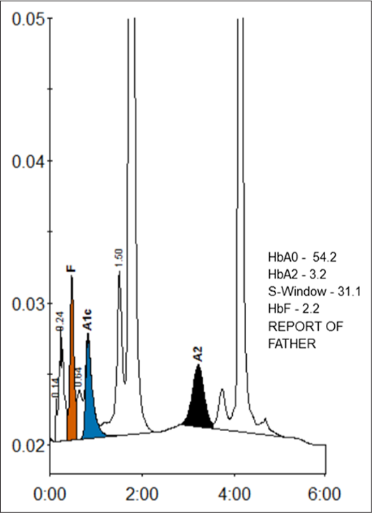 HPLC report showing S-window – 31.1% of area % of graph.