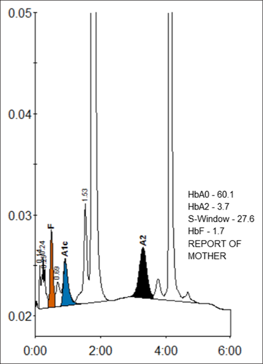 HPLC report showing S-Window – 27.6% of area % of graph.