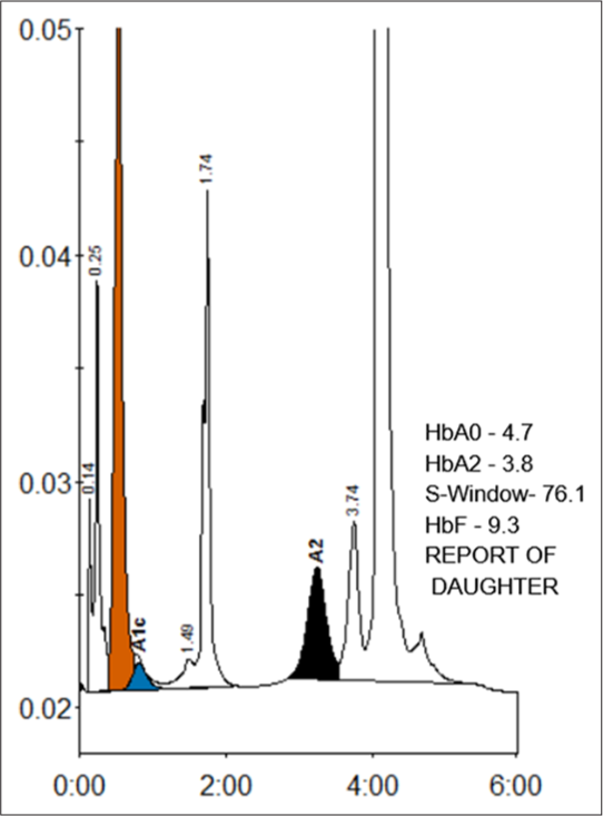 HPLC Report showing S-Window – 76.1% of area % of graph.